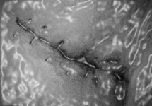 carpal tunnel scar transform (Large).jpg
