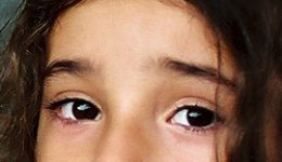 306248-R1-03-2  eyes.JPG