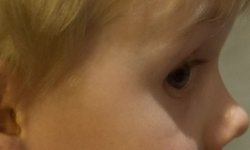 LR_eye.jpg