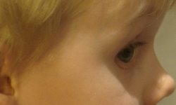 raw_dev_eye.jpg